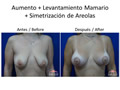 Cirugias combinadas -Dr. Perez Rivera