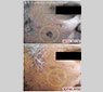 Lesiones Pigmentarias con laser