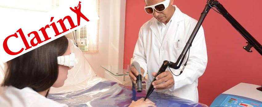 Nota sobre Borramiento de Tatuajes en el diario Clarin