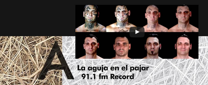 Entrevista de radio sobre borrado de tatuajes con laser.