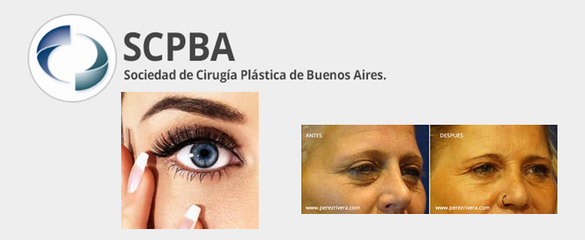 Disertaci�n sobre L�ser aplicado en zona Periorbital